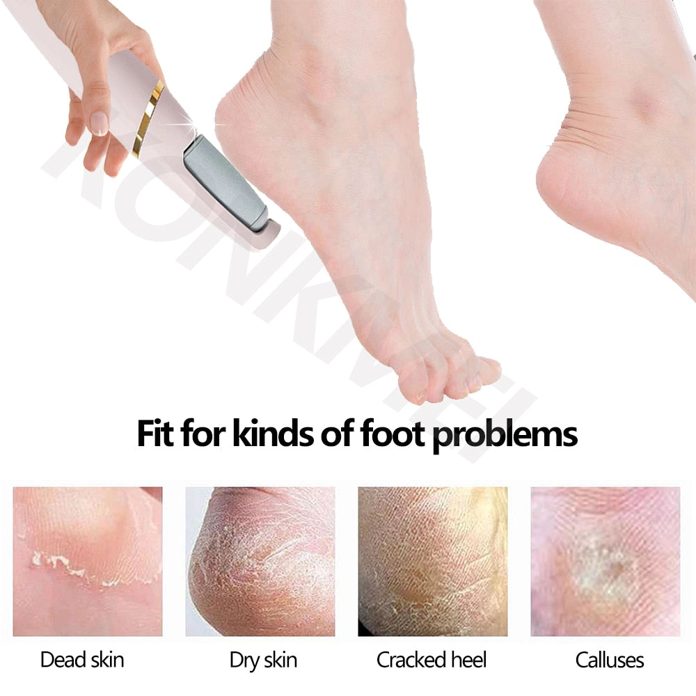 Pedicure Foot Callus Remover tool